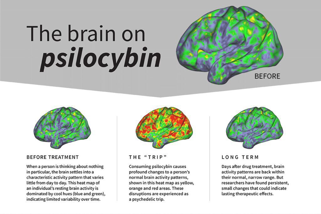Study: Your Brain on Shrooms — How Psilocybin Resets Neural Networks | Research | My Supply Co. Study: Your Brain on Shrooms — How Psilocybin Resets Neural Networks | Research | My Supply Co.